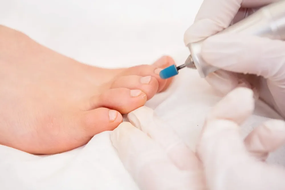 polissage ongle